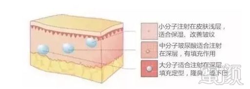https://img.miyanlife.com/mnt/timg/180423/11352J246-4.jpg