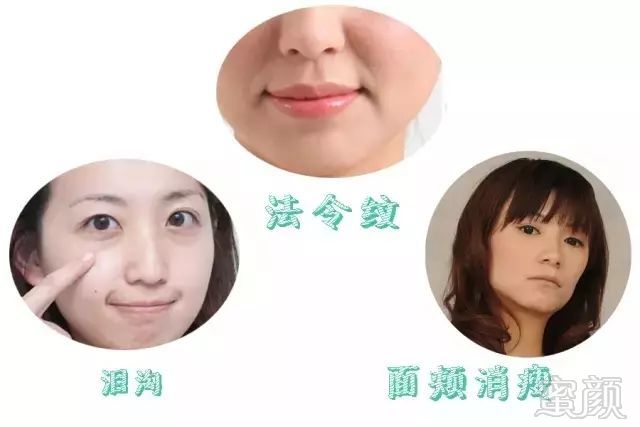 https://img.miyanlife.com/mnt/timg/180423/11352V1H-7.jpg