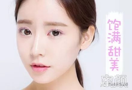 https://img.miyanlife.com/mnt/timg/180423/11352V956-5.jpg