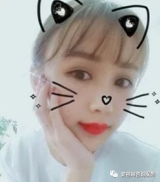 https://img.miyanlife.com/mnt/timg/180423/11412620J-10.jpg