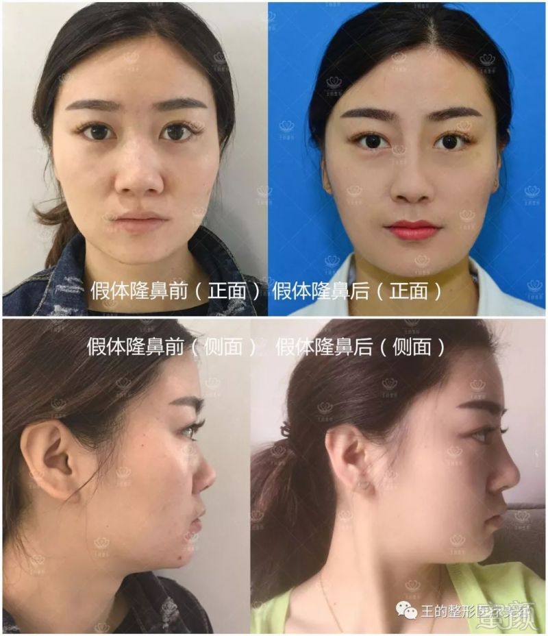 https://img.miyanlife.com/mnt/timg/180423/1151543922-6.jpg