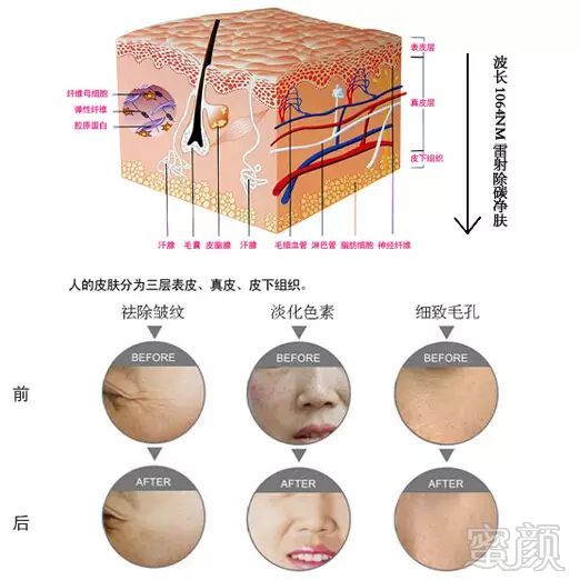 案例图片