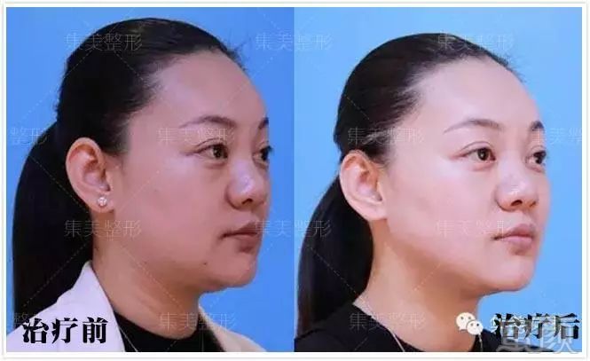 https://img.miyanlife.com/mnt/timg/180423/121A21528-4.jpg