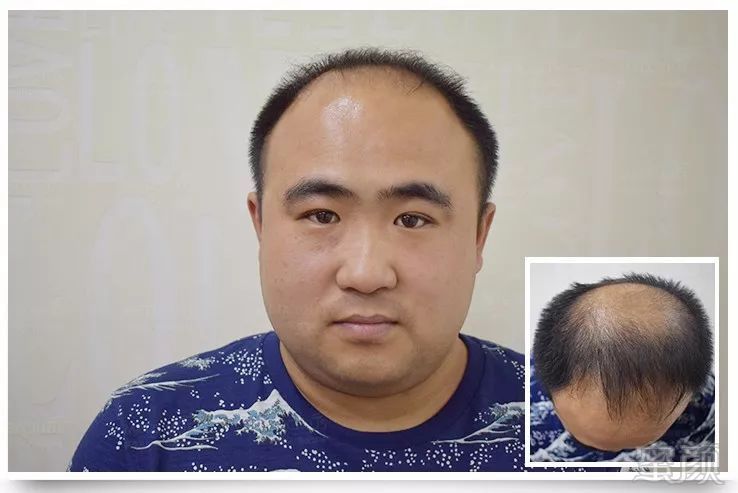 https://img.miyanlife.com/mnt/timg/180424/102A4F52-2.jpg