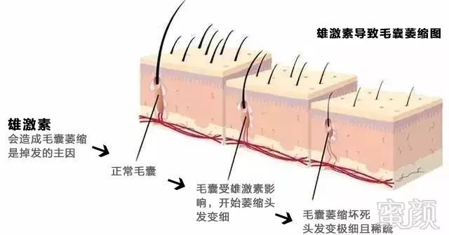 https://img.miyanlife.com/mnt/timg/180424/102A52Z2-4.jpg