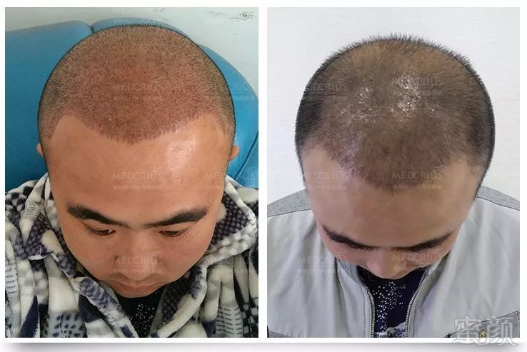 https://img.miyanlife.com/mnt/timg/180424/102A91644-11.jpg
