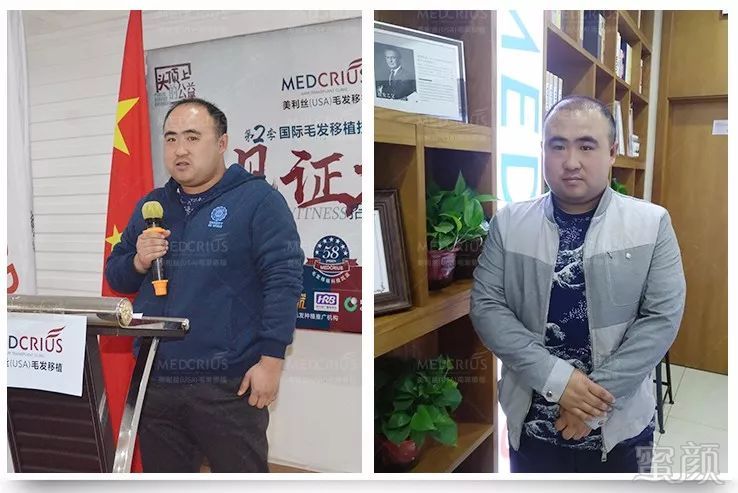 https://img.miyanlife.com/mnt/timg/180424/102A953G-12.jpg