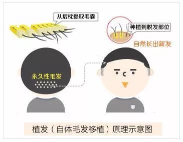 https://img.miyanlife.com/mnt/timg/180424/102AB115-7.jpg