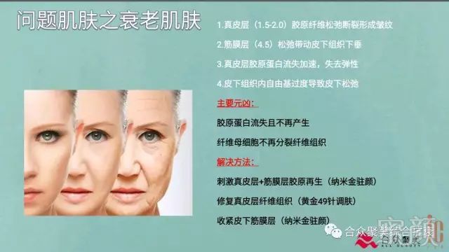https://img.miyanlife.com/mnt/timg/180424/1044161S5-6.jpg