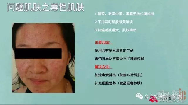 https://img.miyanlife.com/mnt/timg/180424/10441A001-5.jpg