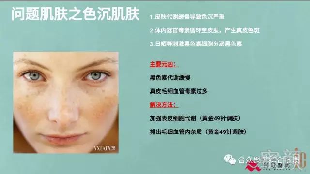 https://img.miyanlife.com/mnt/timg/180424/10441Kb3-7.jpg