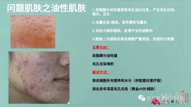 https://img.miyanlife.com/mnt/timg/180424/10441L2U-8.jpg