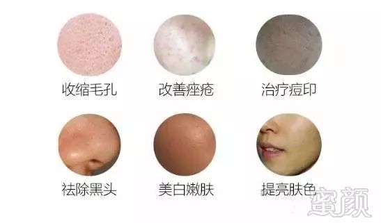 https://img.miyanlife.com/mnt/timg/180424/104I11U3-2.jpg