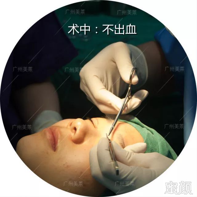 https://img.miyanlife.com/mnt/timg/180424/1052531928-12.jpg