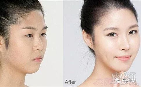 https://img.miyanlife.com/mnt/timg/180424/105H13291-2.jpg