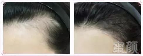 https://img.miyanlife.com/mnt/timg/180424/105PA315-2.jpg
