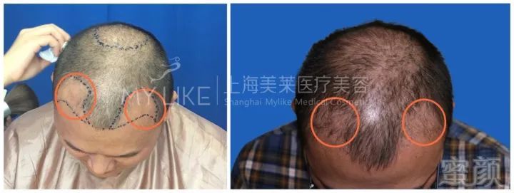https://img.miyanlife.com/mnt/timg/180424/105PM103-6.jpg