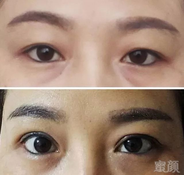 https://img.miyanlife.com/mnt/timg/180424/112253C38-3.jpg