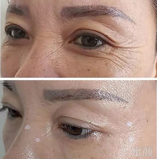 https://img.miyanlife.com/mnt/timg/180424/1122542926-6.jpg