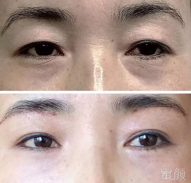 https://img.miyanlife.com/mnt/timg/180424/11225452b-4.jpg