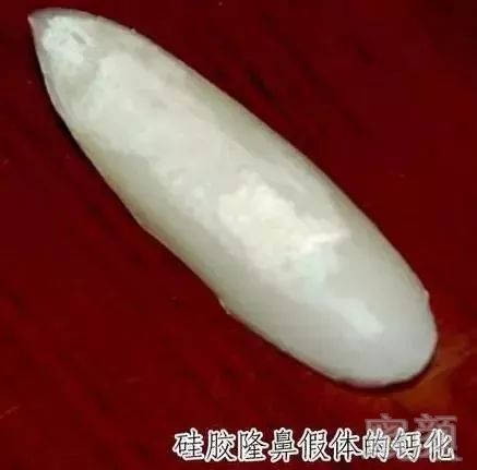 https://img.miyanlife.com/mnt/timg/180424/112IQT0-3.jpg