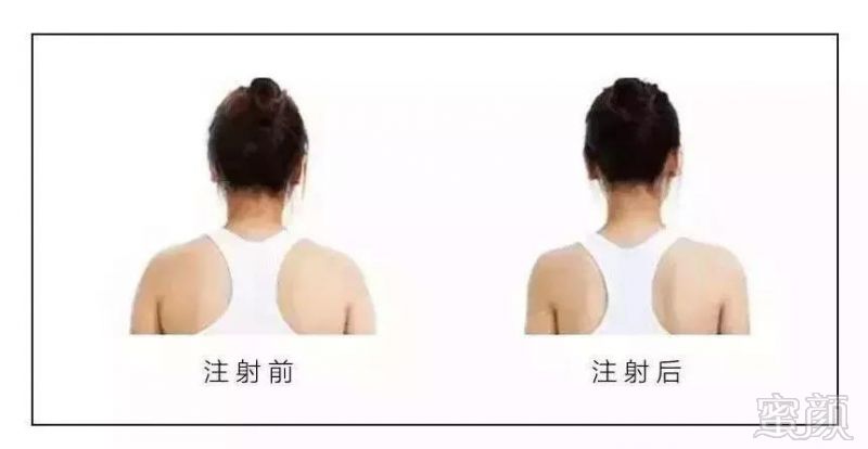 https://img.miyanlife.com/mnt/timg/180424/1423515910-5.jpg