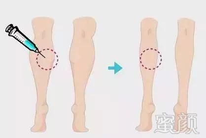 https://img.miyanlife.com/mnt/timg/180424/1423523G6-8.jpg