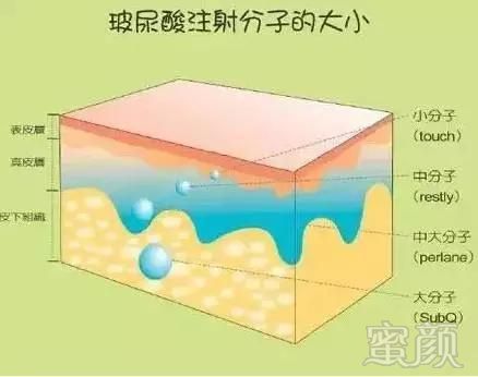 https://img.miyanlife.com/mnt/timg/180424/144003CK-4.jpg