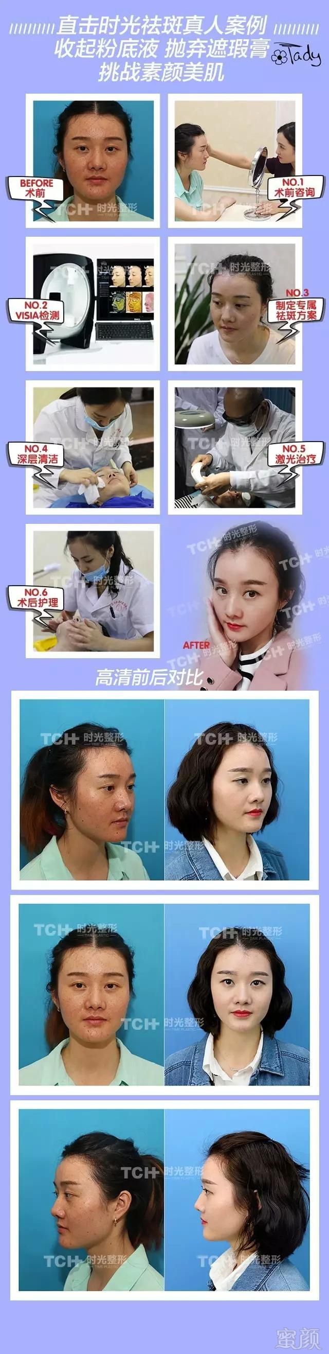 https://img.miyanlife.com/mnt/timg/180424/15141554I-3.jpg