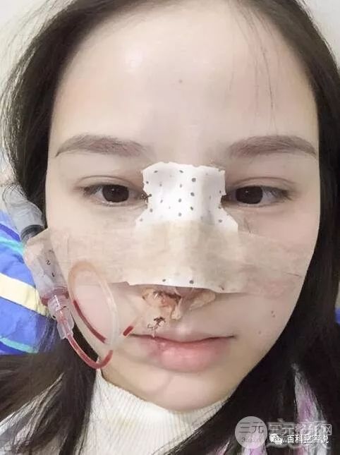 https://img.miyanlife.com/mnt/timg/180425/111203OF-4.jpg