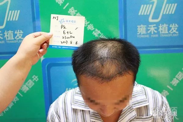 https://img.miyanlife.com/mnt/timg/180425/1125552917-0.jpg