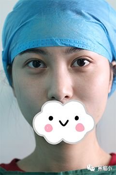 https://img.miyanlife.com/mnt/timg/180425/1126033204-0.jpg