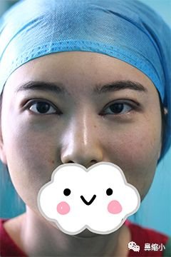 https://img.miyanlife.com/mnt/timg/180425/11260414M-2.jpg