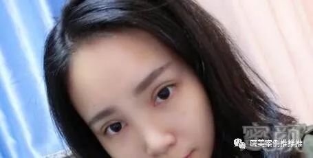 https://img.miyanlife.com/mnt/timg/180425/1152153952-3.jpg