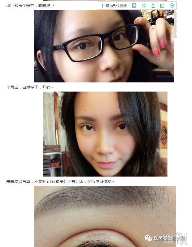 https://img.miyanlife.com/mnt/timg/180425/1152162327-8.jpg