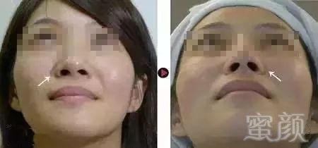 https://img.miyanlife.com/mnt/timg/180425/115G41O5-5.jpg