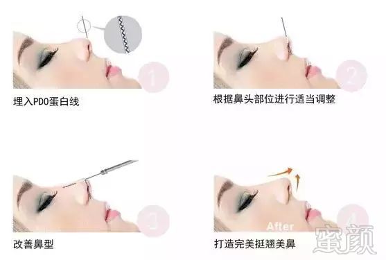 https://img.miyanlife.com/mnt/timg/180425/115G41P7-2.jpg