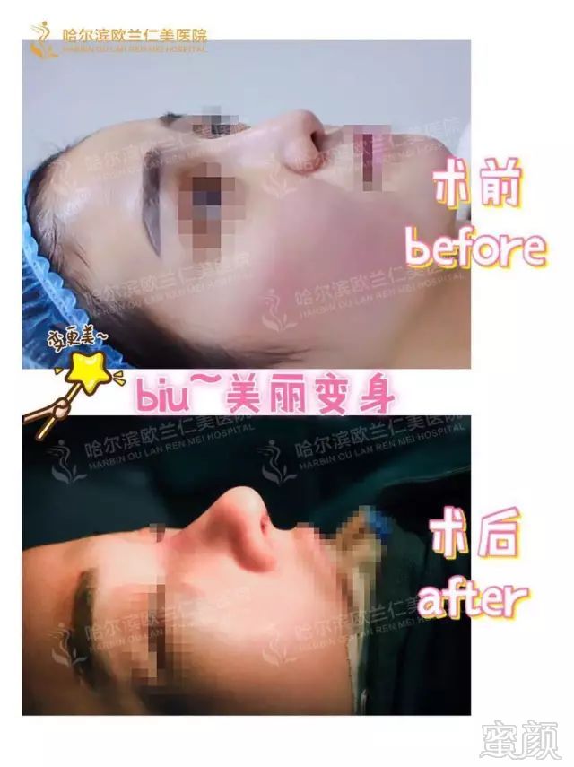https://img.miyanlife.com/mnt/timg/180425/115T01638-7.jpg