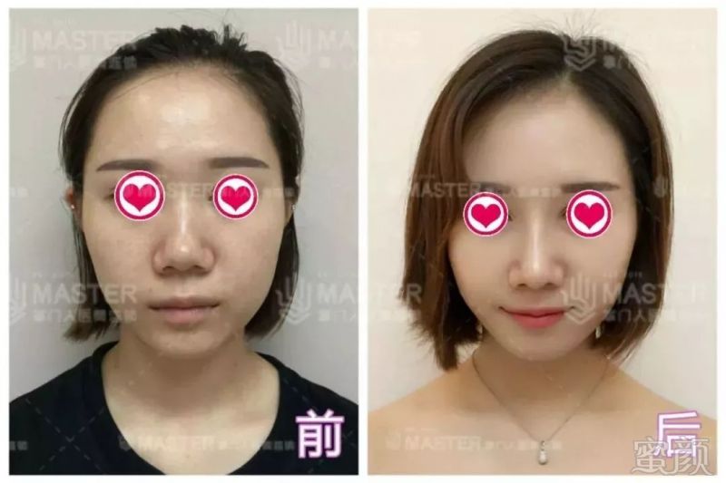 https://img.miyanlife.com/mnt/timg/180425/12021934Y-14.jpg