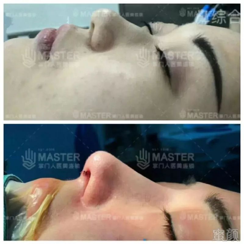 https://img.miyanlife.com/mnt/timg/180425/1202195O0-13.jpg