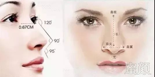 https://img.miyanlife.com/mnt/timg/180425/12021S055-6.jpg