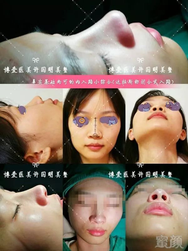 https://img.miyanlife.com/mnt/timg/180425/12035U401-6.jpg