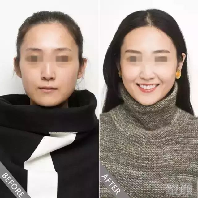 https://img.miyanlife.com/mnt/timg/180425/1209343428-2.jpg