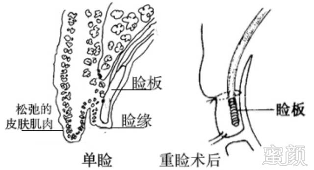 案例图片