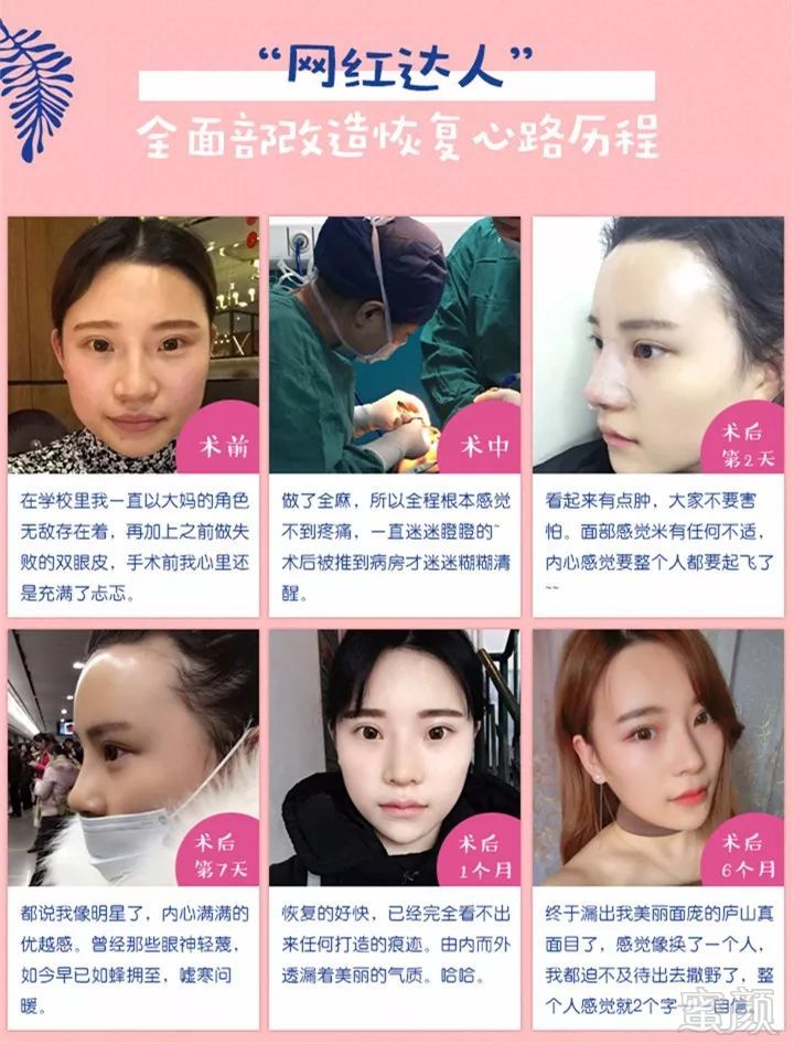 https://img.miyanlife.com/mnt/timg/180425/12191033E-3.jpg