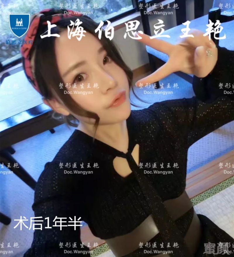https://img.miyanlife.com/mnt/timg/180425/121910EP-4.jpg