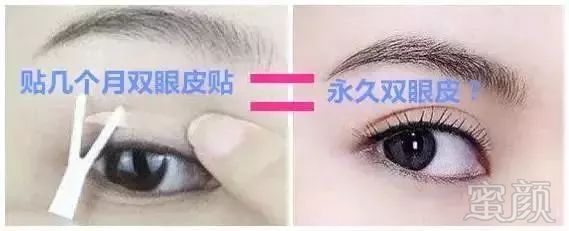 https://img.miyanlife.com/mnt/timg/180425/121F46341-0.jpg