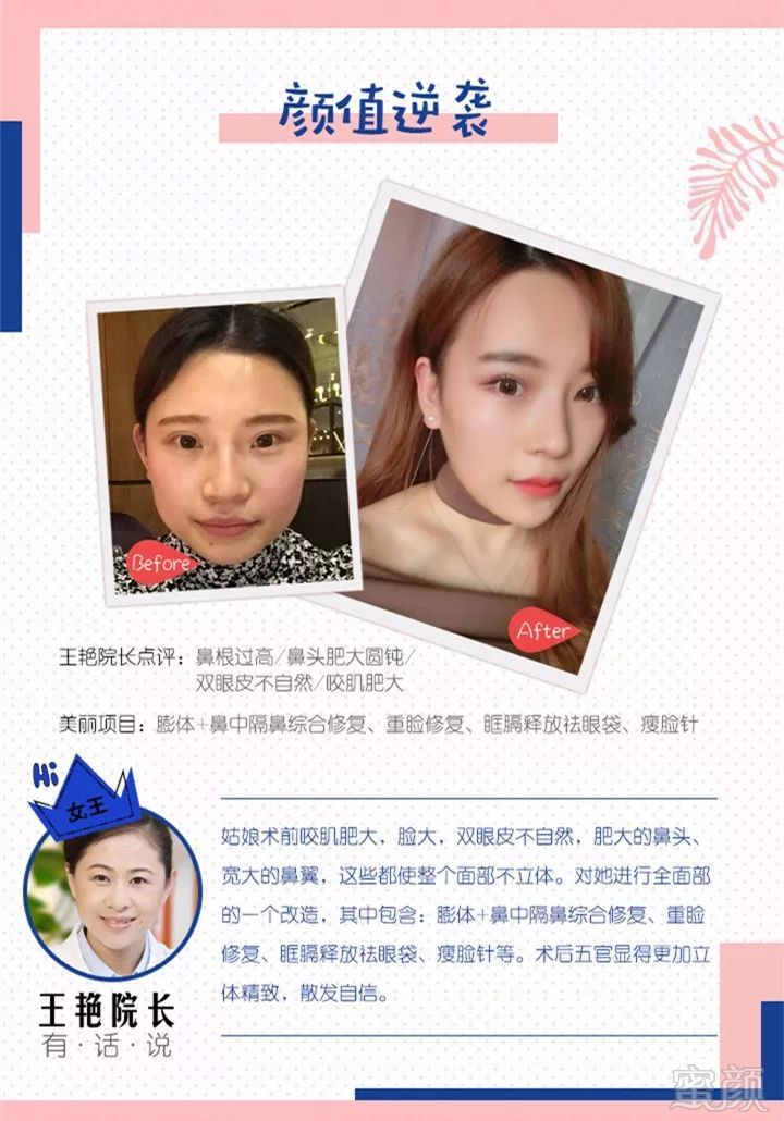 https://img.miyanlife.com/mnt/timg/180425/121Z93258-2.jpg