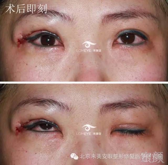 https://img.miyanlife.com/mnt/timg/180425/1226252D3-2.jpg