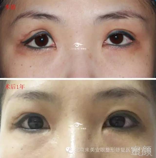 https://img.miyanlife.com/mnt/timg/180425/1226253F2-0.jpg